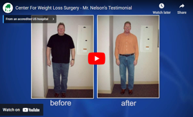 Center For Weight Loss Surgery - Mr. Nelsons Testimonial