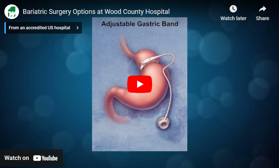 Center for Weight Loss - Bariatric Surgery Options
