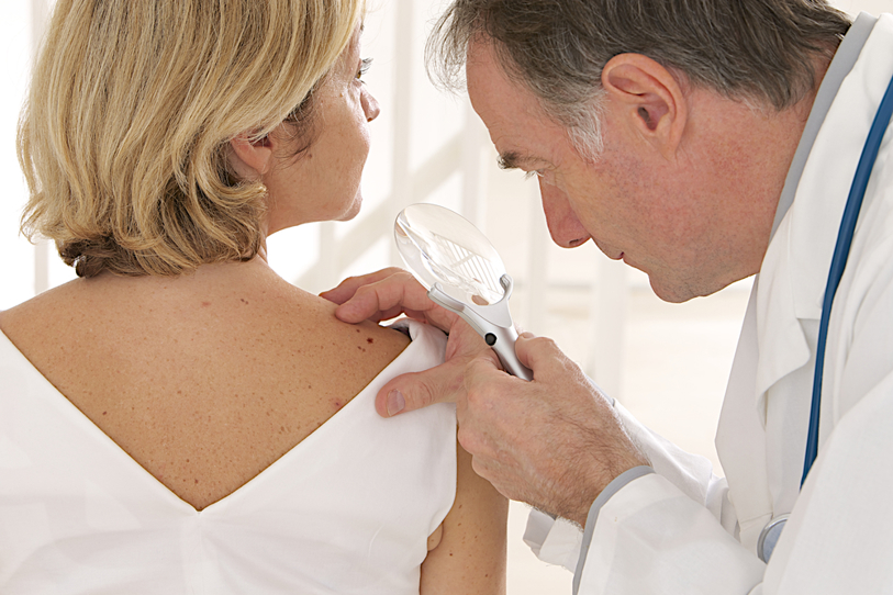 A Brief Overview of Skin Cancer Symptoms